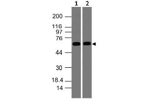 Image no. 1 for anti-SWAP Switching B-Cell Complex 70kDa Subunit (SWAP70) (AA 300-505) antibody (ABIN5027556) (SWAP70 Antikörper  (AA 300-505))