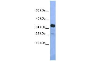 WB Suggested Anti-Klhdc9 Antibody Titration: 1.