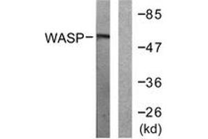 Western blot analysis of extracts from HepG2 cells, using WASP (Ab-290) Antibody. (WASP Antikörper  (AA 256-305))