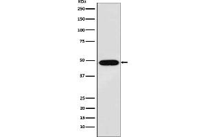 Western blot analysis of MAGE 1 expression in A375 cell lysate.