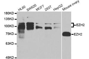 Western blot analysis of extracts of various cell lines, using EZH2 antibody. (EZH2 Antikörper)