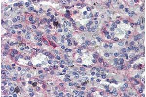 Immunohistochemistry (Formalin-fixed Paraffin-embedded Sections) (IHC (fp)) image for anti-ADAM Metallopeptidase Domain 8 (ADAM8) (AA 763-824) antibody (ABIN573994)