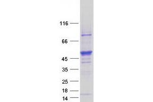 Validation with Western Blot (STK25 Protein (Myc-DYKDDDDK Tag))