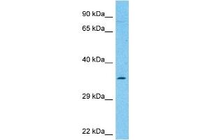 Host:  Rabbit  Target Name:  NCEH1  Sample Type:  THP-1 Whole Cell lysates  Antibody Dilution:  1.