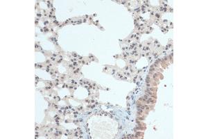Immunohistochemistry of paraffin-embedded Mouse lung using Thioredoxin 1 (Trx1/Thioredoxin 1 (Trx1/TXN)) antibody (ABIN7270798) at dilution of 1:100 (40x lens). (TXN Antikörper  (C-Term))