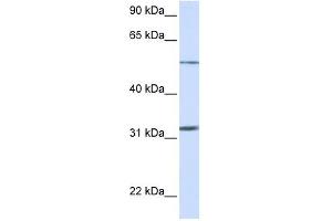 SLC35A5 antibody used at 1 ug/ml to detect target protein. (SLC35A5 Antikörper  (N-Term))