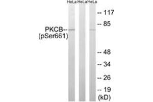 Western blot analysis of extracts from HeLa cells treated with heat shock, using PKCB (Phospho-Ser661) Antibody. (PKC beta Antikörper  (pSer661))