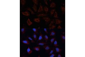 Immunofluorescence analysis of U2OS cells using  antibody (ABIN6129706, ABIN6136901, ABIN6136902 and ABIN6214776) at dilution of 1:100. (ANO1 Antikörper  (AA 628-731))