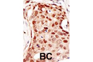 Immunohistochemistry (IHC) image for anti-Cbl proto-oncogene C (CBLC) antibody (ABIN2996838) (CBLC Antikörper)