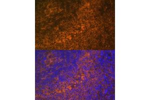 Immunofluorescence analysis of rat spleen using TNFRSF10A Polyclonal Antibody (ABIN6127583, ABIN6149301, ABIN6149303 and ABIN6216204) at dilution of 1:100 (40x lens). (TNFRSF10A Antikörper  (AA 269-468))