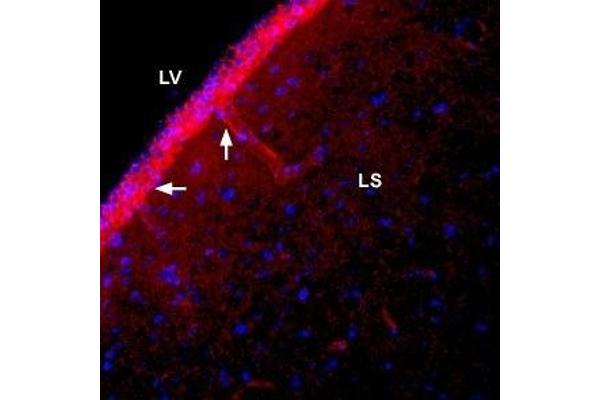 SLC4A4 Antikörper  (Extracellular)