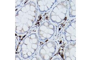 Immunohistochemistry (IHC) image for anti-Ubiquitin-Conjugating Enzyme E2L 6 (UBE2L6) antibody (ABIN1683197)