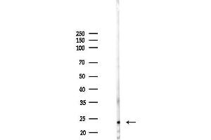 anti-N(alpha)-Acetyltransferase 40 (NAA40) antibody