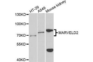 Western blot analysis of extracts of various cells, using MARVELD2 antibody.