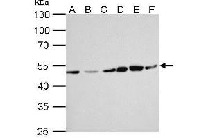 WB Image ERCC8 antibody [N2C2], Internal detects ERCC8 protein by Western blot analysis. (ERCC8 Antikörper  (Internal Region))