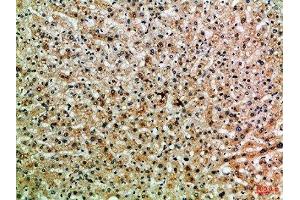 Immunohistochemical analysis of paraffin-embedded Human-liver, antibody was diluted at 1:100 (PPP1R13B Antikörper  (AA 630-680))