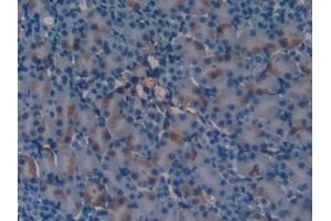 Immunohistochemistry (IHC) image for anti-serpin Peptidase Inhibitor, Clade A (Alpha-1 Antiproteinase, Antitrypsin), Member 6 (SERPINA6) (AA 57-256) antibody (ABIN7438406)