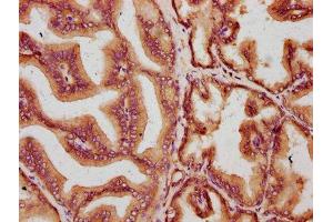 Immunohistochemistry (IHC) image for anti-Muskelin 1, Intracellular Mediator Containing Kelch Motifs (MKLN1) (AA 488-614) antibody (ABIN7160369)