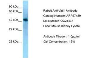 Image no. 1 for anti-Vesicle Amine Transport 1-Like (VAT1L) (AA 80-129) antibody (ABIN6749938)