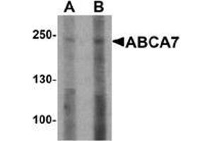 Western blot analysis of ABCA7 in 293 cell lysate with ABCA7 antibody at (A) 1 and (B) 2 ug/mL. (ABCA7 Antikörper  (N-Term))