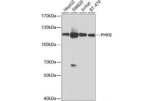 Western blot analysis of extracts of various cell lines using PHKB Polyclonal Antibody at dilution of 1:1000. (PHKB Antikörper)