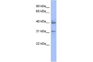 WB Suggested Anti-PABPN1 Antibody Titration: 0. (PABPN1 Antikörper  (N-Term))