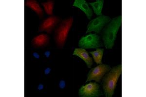 ABIN6258204 and ABIN6273883 staining  cells by IF/ICC. (GPR56 Antikörper  (C-Term))