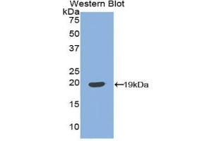 Western blot analysis of the recombinant protein. (IGFBP3 Antikörper  (AA 106-241))