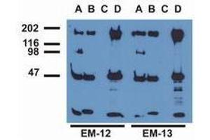 Western Blotting (WB) image for anti-Epidermal Growth Factor Receptor (EGFR) (pTyr1197) antibody (ABIN400879) (EGFR Antikörper  (pTyr1197))