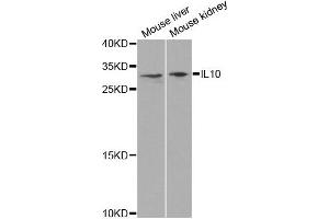 Western blot analysis of extracts of mouse liver and mouse kidney cell lines, using IL10 antibody.