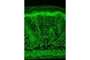 Immunohistochemistry analysis using Mouse Anti-HIF1 alpha Monoclonal Antibody, Clone ESEE122 . (HIF1A Antikörper  (AA 329-530) (Atto 488))