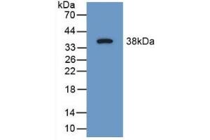 Detection of Recombinant SYN1, Mouse using Polyclonal Antibody to Synapsin I (SYN1) (SYN1 Antikörper  (AA 113-420))