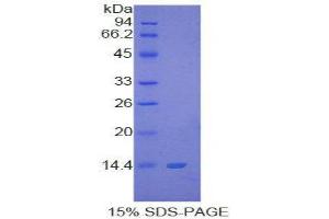SDS-PAGE (SDS) image for S100 Calcium Binding Protein B (S100B) (AA 1-92) protein (His tag) (ABIN1099445)