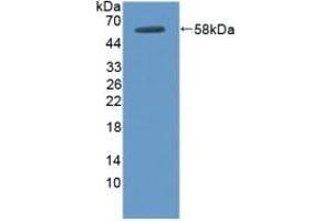 Detection of Recombinant DOK3, Human using Polyclonal Antibody to Docking Protein 3 (DOK3) (DOK3 Antikörper  (AA 128-385))