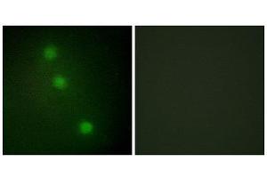 Immunofluorescence (IF) image for anti-Activating Transcription Factor 1 (AFT1) (C-Term) antibody (ABIN1849218)