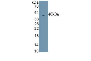 Detection of Recombinant MIP1b, Simian using Polyclonal Antibody to Macrophage Inflammatory Protein 1 Beta (MIP1b) (CCL4 Antikörper  (AA 1-92))