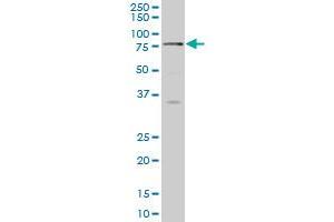 SCMH1 monoclonal antibody (M02), clone 1H2 Western Blot analysis of SCMH1 expression in HepG2 . (SCMH1 Antikörper  (AA 404-502))