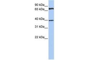 Image no. 1 for anti-Membrane Protein, Palmitoylated 5 (MAGUK P55 Subfamily Member 5) (MPP5) (AA 36-85) antibody (ABIN6740785) (MPP5 Antikörper  (AA 36-85))