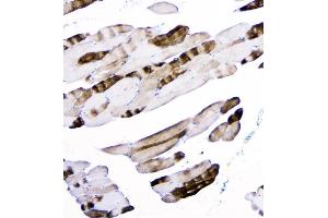 IHC analysis of ACTN3 using anti-ACTN3 antibody (ABIN6719273). (ACTN3 Antikörper  (C-Term))
