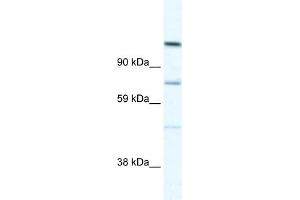 WB Suggested Anti-D930005D10RIK Antibody Titration:  5.