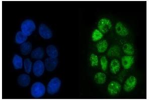 IF analysis of p95 NBS1 using anti-p95 NBS1 antibody (ABIN7602793).