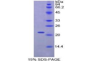 SDS-PAGE analysis of Rat Centromere Protein E Protein.
