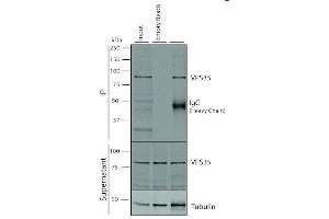Immunoprecipitation analysis using Mouse Anti-VPS35 Monoclonal Antibody, Clone 5A9 (ABIN6932954). (VPS35 Antikörper  (PE))