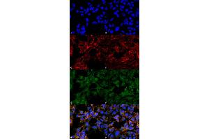 Immunocytochemistry/Immunofluorescence analysis using Mouse Anti-Malondialdehyde Monoclonal Antibody, Clone 6H6 . (Malondialdehyde Antikörper  (Atto 488))