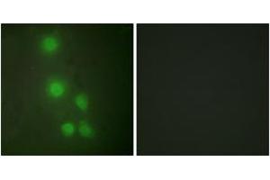 Immunofluorescence analysis of HuvEc cells, using ACTL6A Antibody.