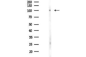 Western blot analysis of lysates from Mouse lung, using TLK1 Antibody at 1/1000 dilution.