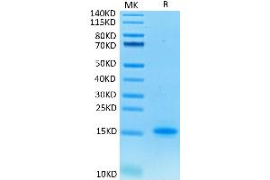 Human CD3E on Tris-Bis PAGE under reduced condition. (CD3 epsilon Protein (CD3E) (His tag))