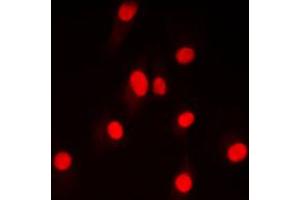 Immunofluorescent analysis of DNA Ligase 4 staining in HepG2 cells. (LIG4 Antikörper  (Center))