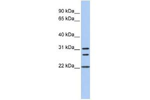 WB Suggested Anti-CNN1 Antibody Titration:  0. (CNN1 Antikörper  (N-Term))