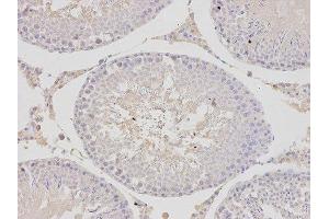 Immunohistochemistry (IHC) image for anti-Proteasome (Prosome, Macropain) 26S Subunit, ATPase, 4 (PSMC4) antibody (ABIN1874384) (PSMC4 Antikörper)